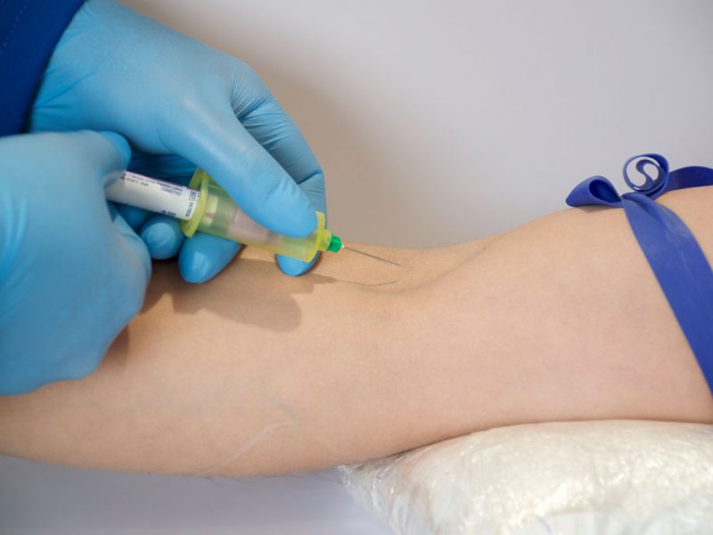 1Exámenes-de-Hematología